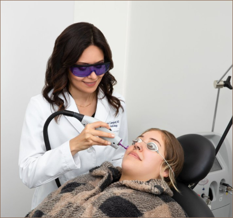 Laser Treatments for Redness and Rosacea of the Skin in San Francisco