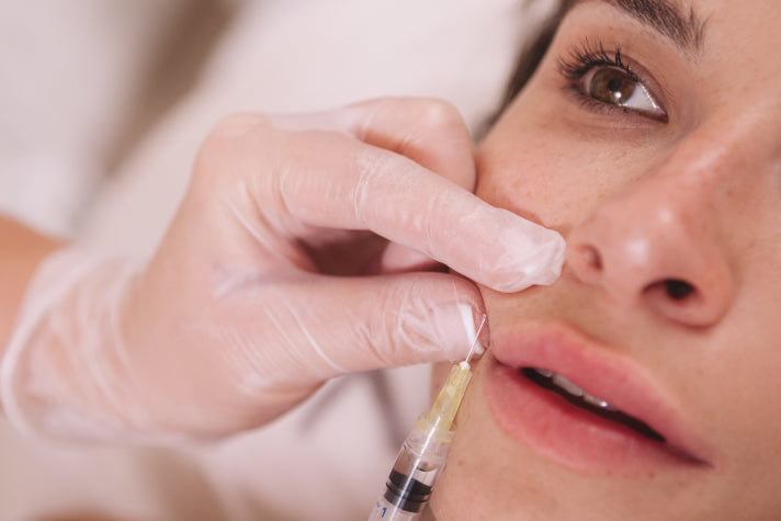 Close-up of a dermatologist injecting collagen stimulators into a patient's skin, focusing on the professional procedure aimed at enhancing skin elasticity and promoting collagen production in a clinical setting.