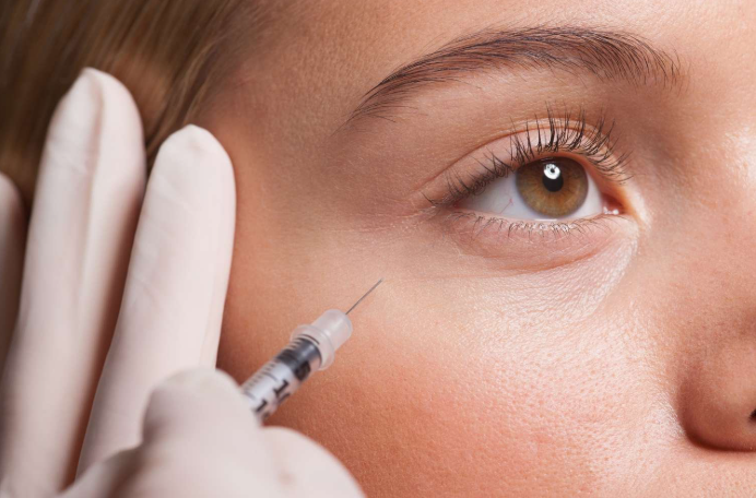 Close-up of a young fair-skinned woman with visible fine lines around her eyes, as a dermatologist's gloved hand administers wrinkle relaxers with a thin syringe.